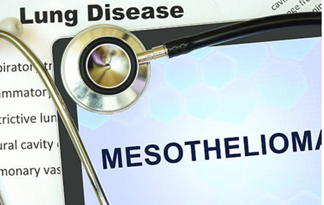 Mesothelioma Law Firm